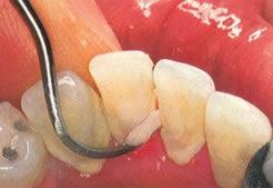 Hygienist
